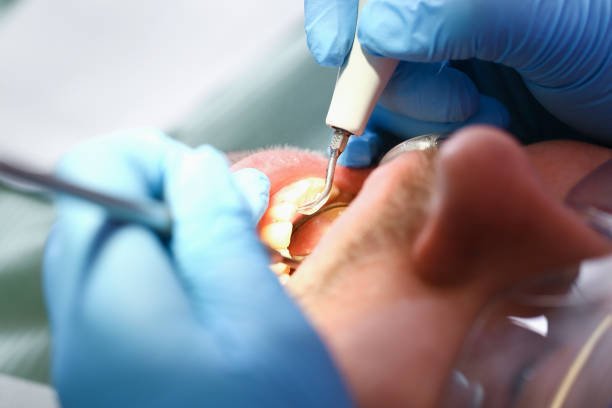 Best Walk-In Emergency Dentist in Anniston, AL